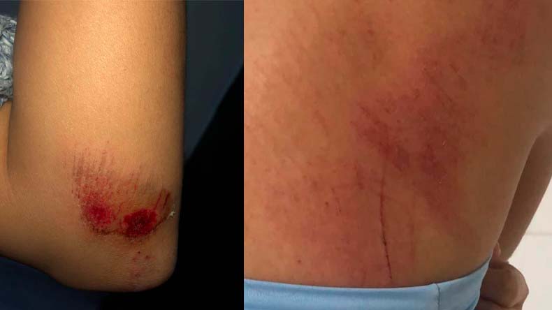 Mujer golpeada estacion de gasolina