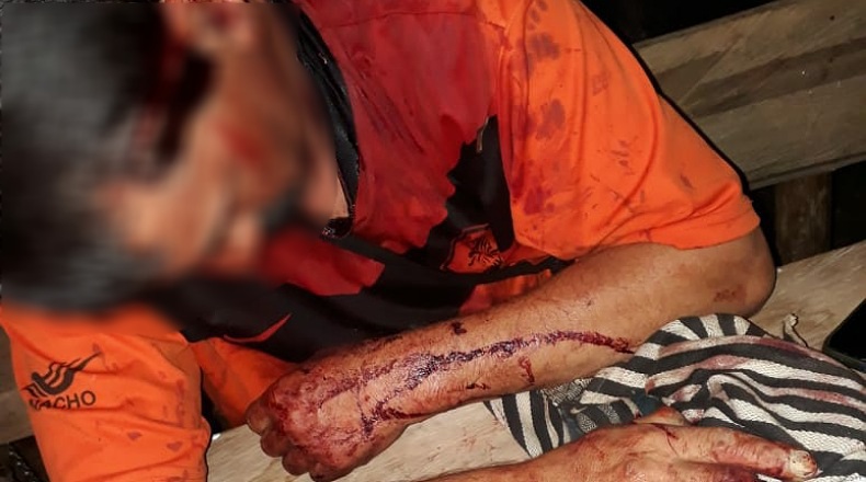 Asesino del perrito borroso